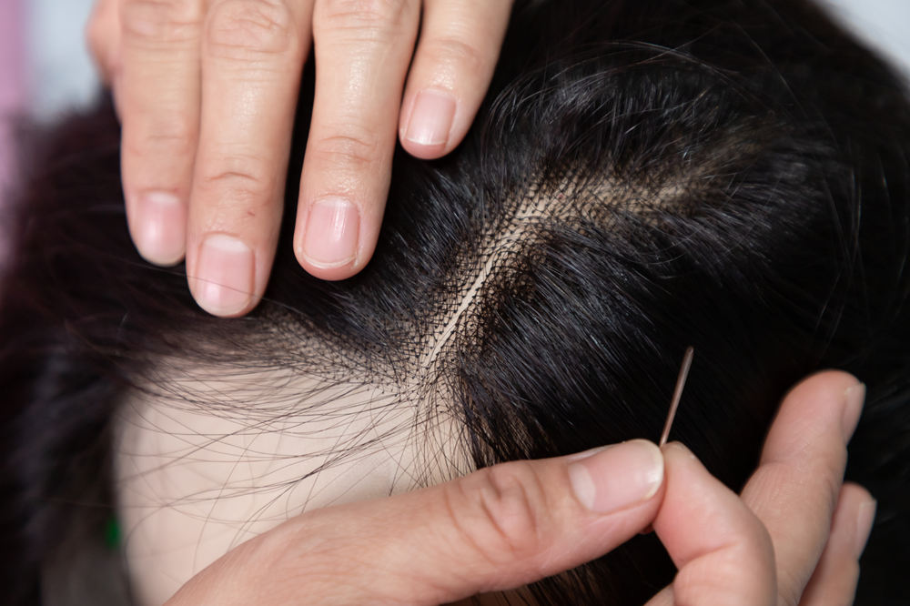 Hair Density Checking